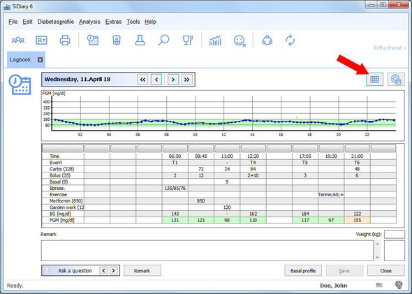 SiDiary with FGM curve of the current day