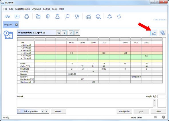 SiDiary with BG table of the current day